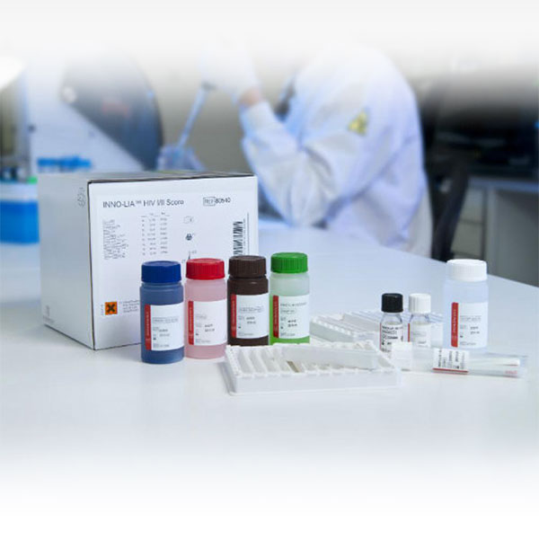 Puntuación INNO-LIA® HIV I/II